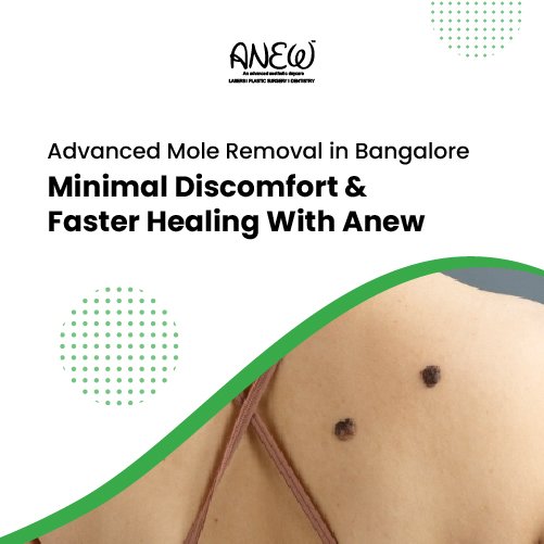 mole removal in bangalore